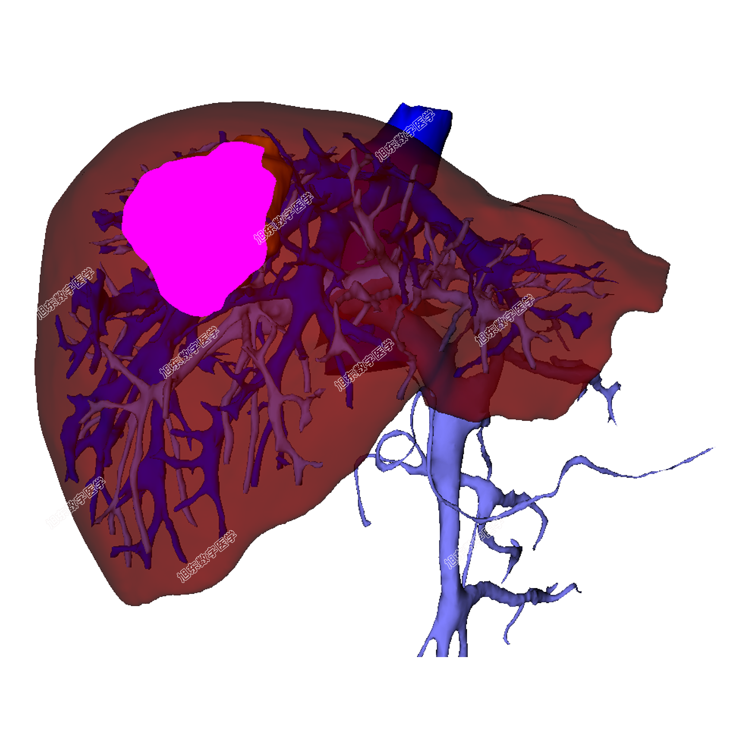 表面映射精准定位